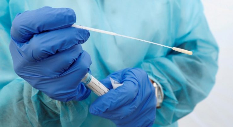 Teste PCR deteção Covid